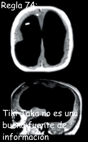 Regla 74.png