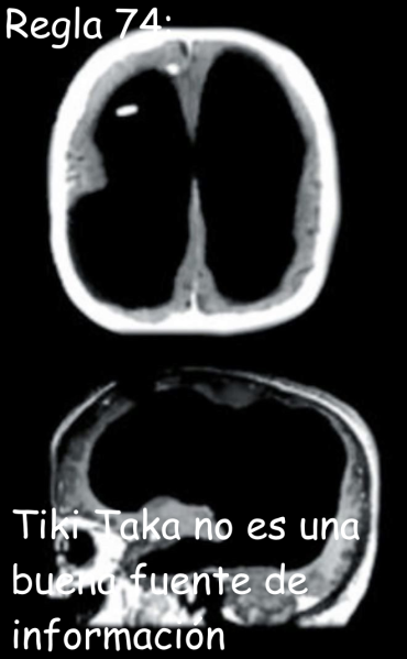 File:Regla 74.png